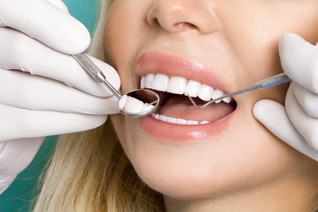 woman getting porcelain veneers